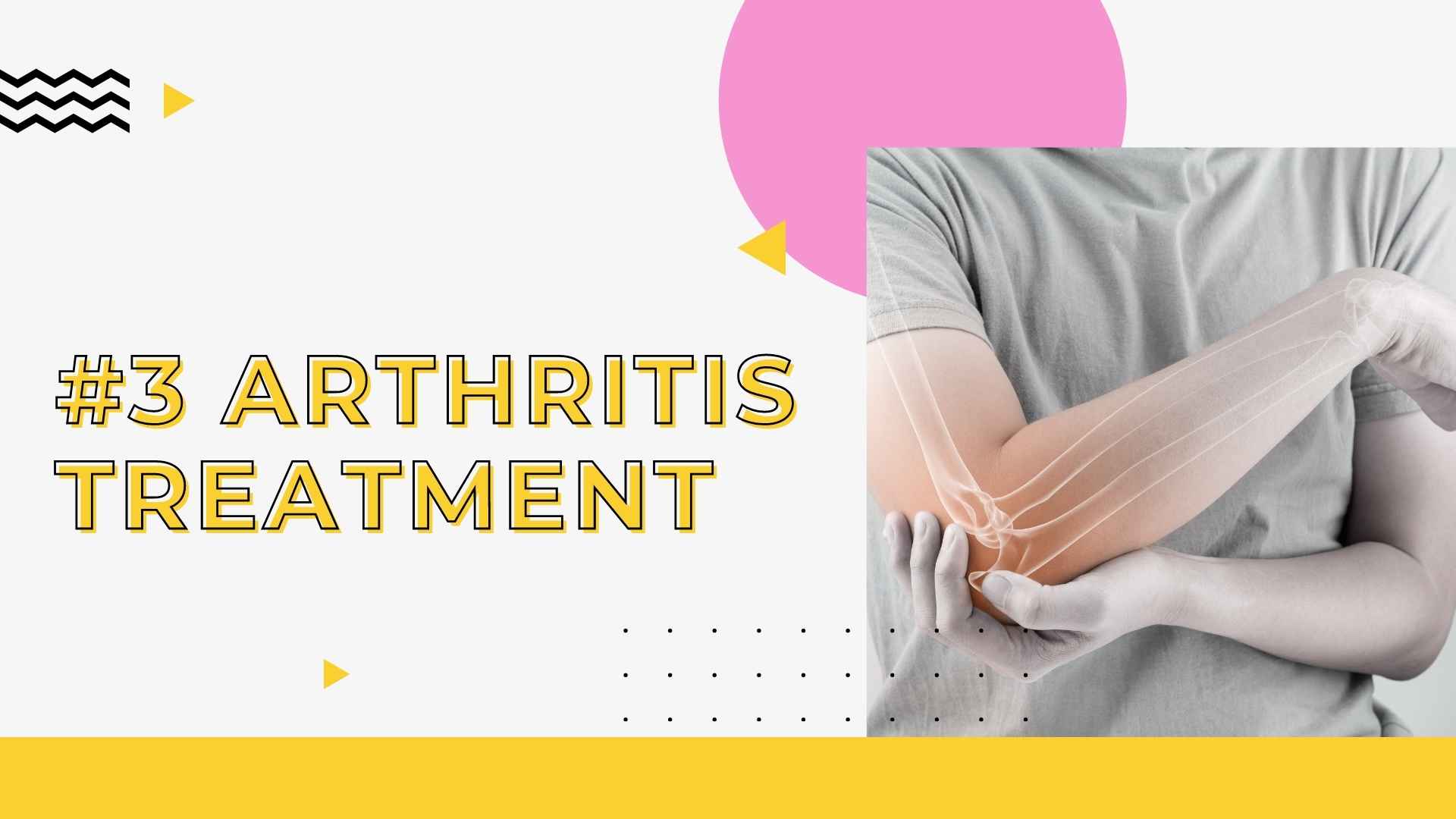 #3 Arthritis Treatment 