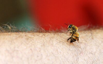 How to Use Bee Venom for Better Health